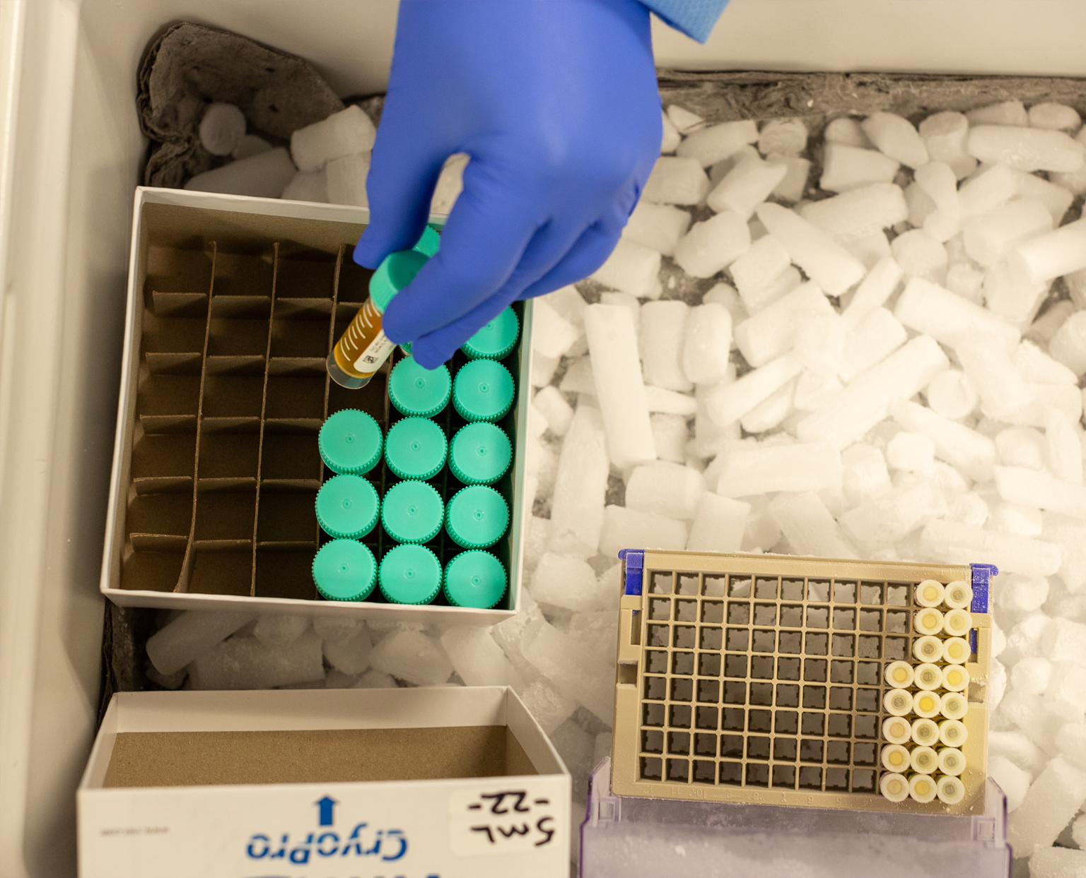 Biospecimen SmartSourcing | Discovery Life Sciences