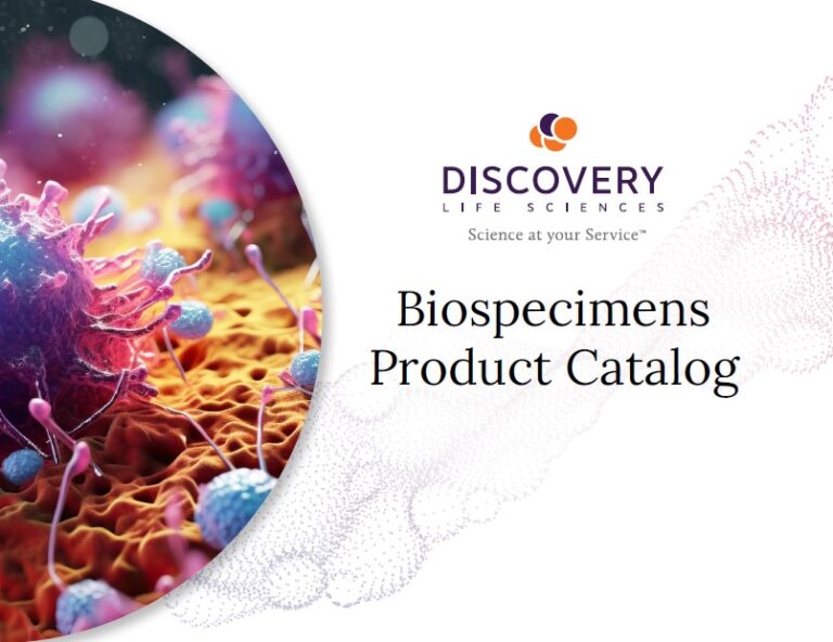 Biospecimens Catalog | Discovery Life Sciences